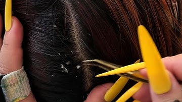 Latte ASMR Scalp Therapy | Gentle Tweezer Triggers for Deep Relaxation (No Talking)