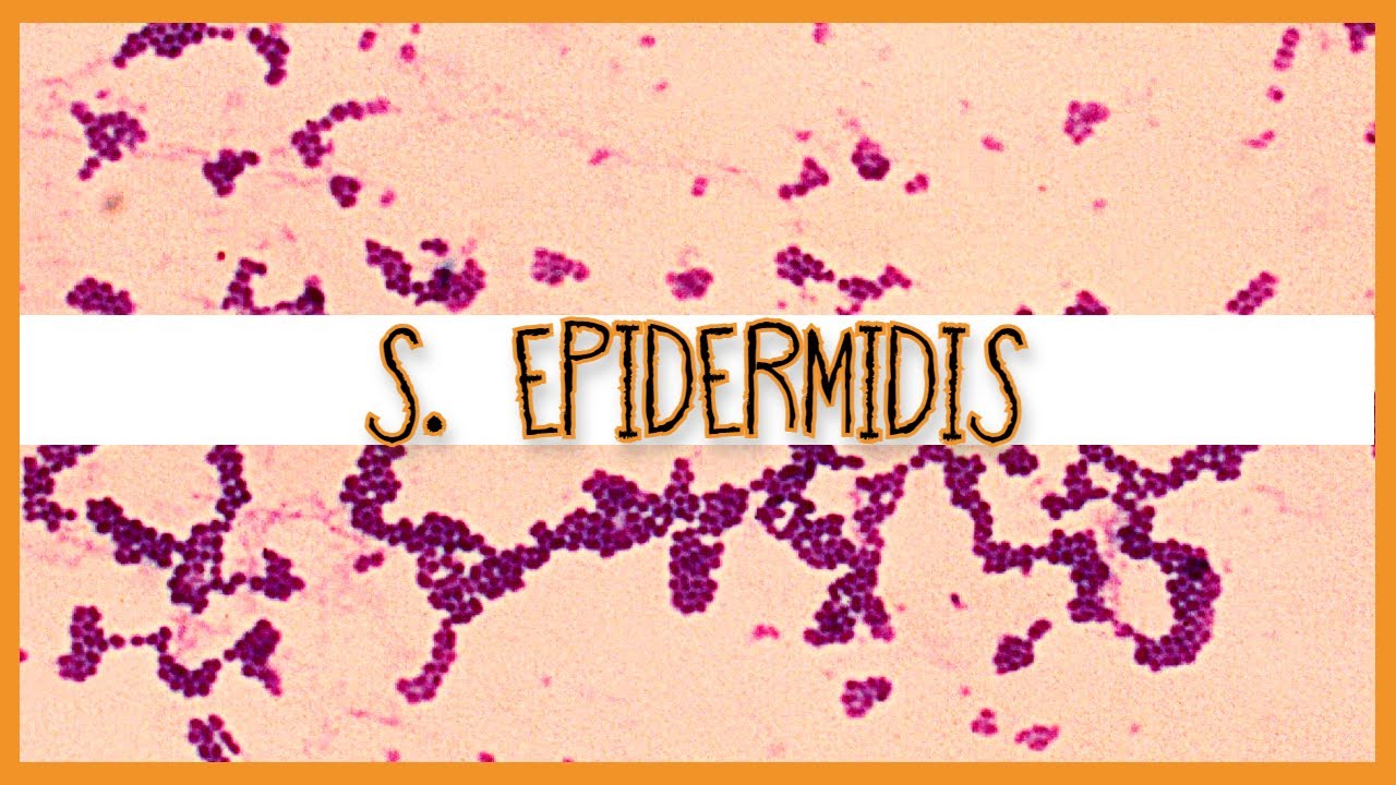 staphylococcus epidermis epidermidi