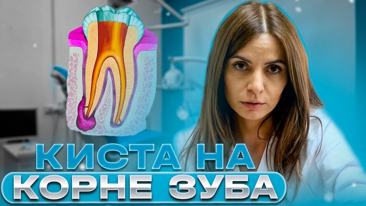 Если обнаружена киста на корне зуба, лечить или удалять? Студия Улыбок