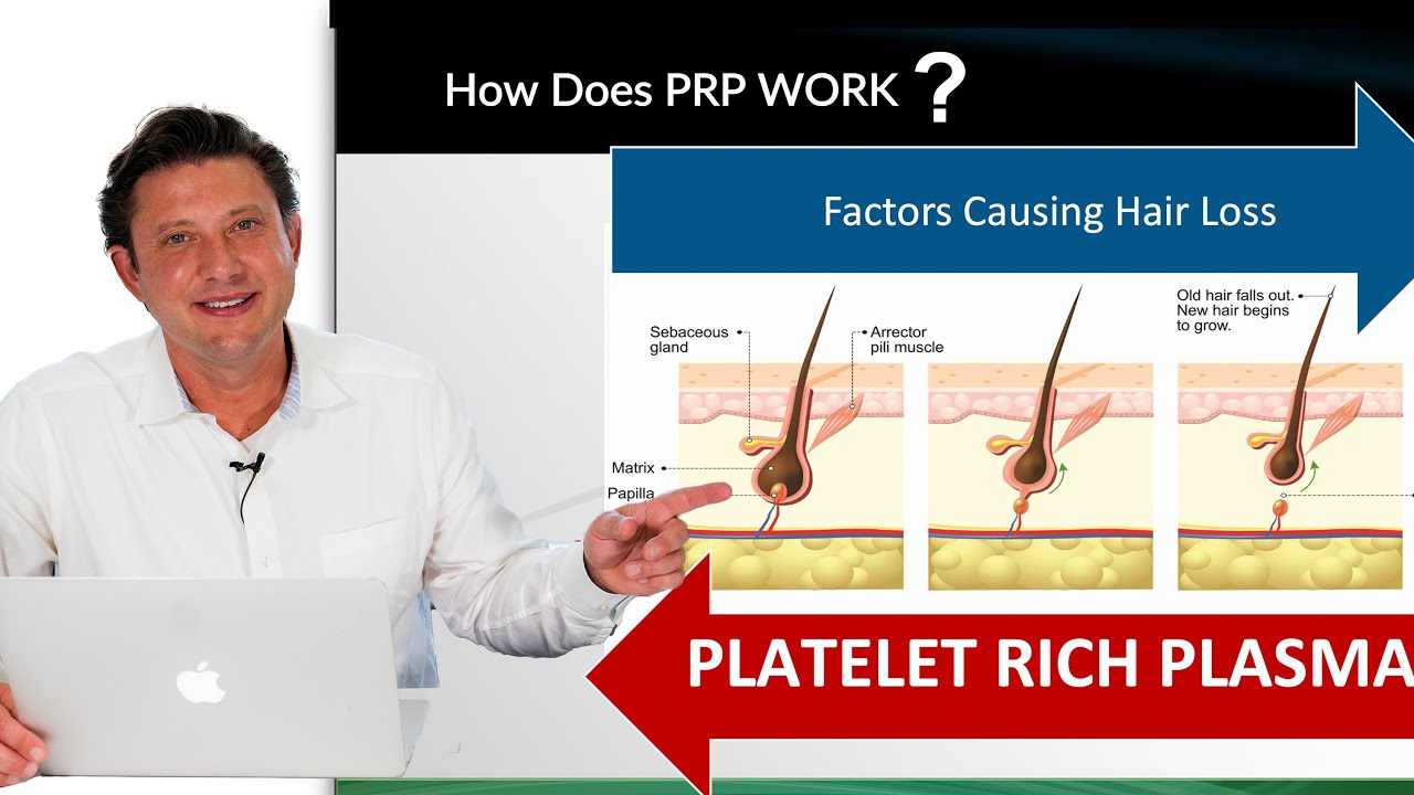 Platelet-Rich Plasma For Hair Loss, Does It Work? | NEHair®