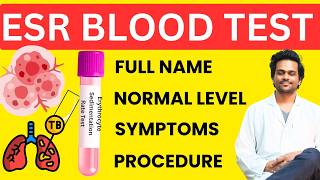 ESR Test : Meaning, Normal Range, Procedure, Symptoms | Erythrocyte Sedimentation Rate Blood Test