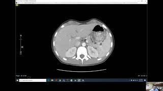 Looking Inside Your Abdomen at Atlantic Medical Imaging
