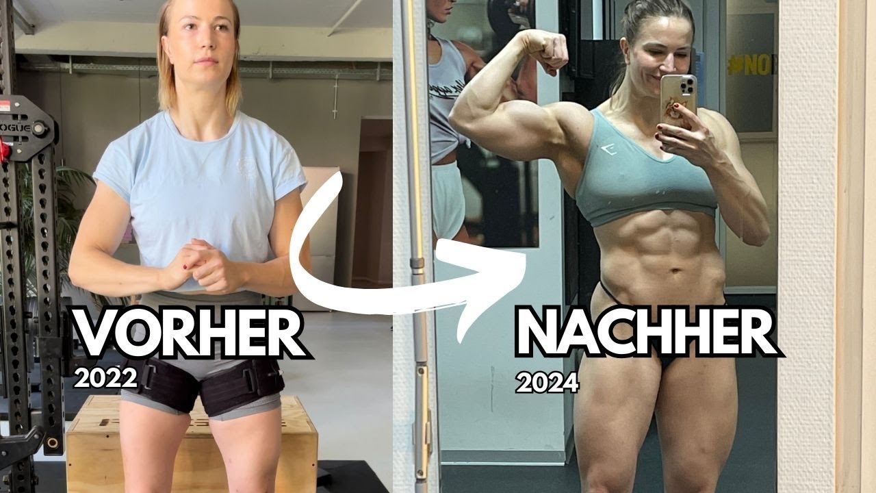 Habe ich DÜNNE Beine? (Post OP Fortschritt) in DASGYM. / WIEN
