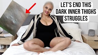 If Your Dark Inner Thighs Keep coming Back? This video is for you