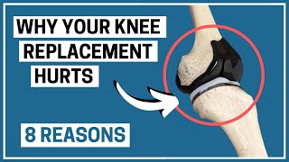 Why is your Knee Replacement painful? 8 possible reasons