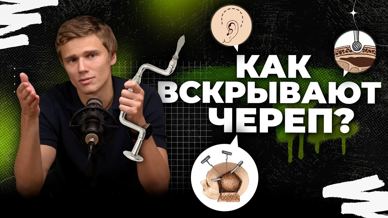 Процесс трепанации черепа