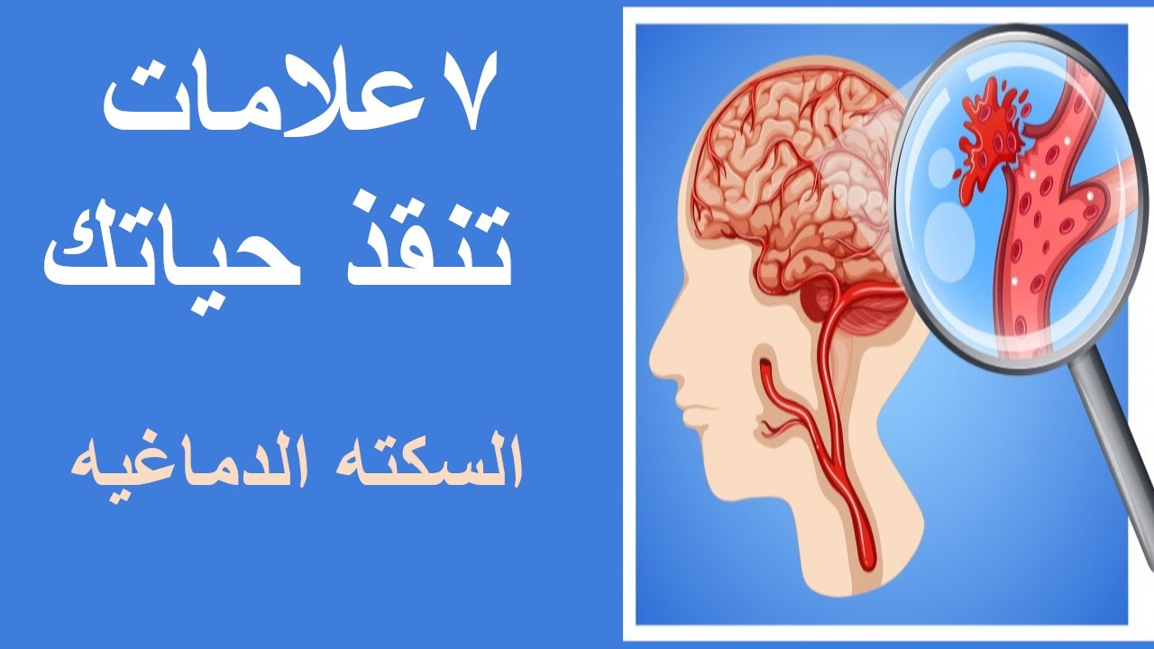 اعراض الجلطه الدماغيه وطرق الوقايه منها| اسباب السكتات الدماغية|stroke| ٧ علامات تنقذ حياتك