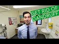 Dandruff | How To Get Rid Of Dandruff (2018)