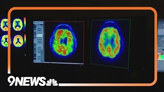 New blood test can help diagnose Alzheimer's disease