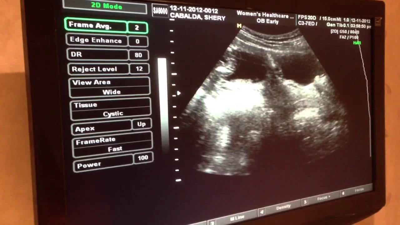 17-weeks-and-3-days-youtube