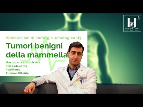 Video: Papilloma Intraduttale Del Seno: Sintomi, Trattamento, Intervento Chirurgico