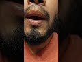Dia 131.9-180 |Barba? Aplica Minoxidil (LCarnitine) para crecer BARBA GRANDE