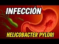 ⚕️🩺 INFECCIÓN POR HELICOBACTER PYLORI: SÍNTOMAS Y TRATAMIENTO