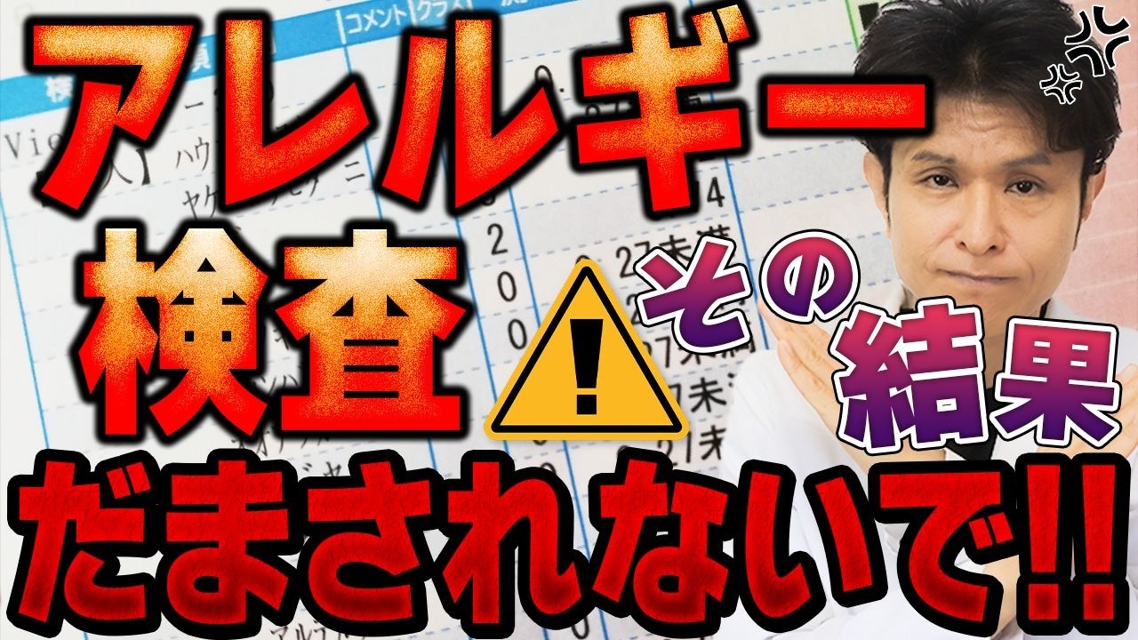 【要注意】アレルギー検査って本当に意味あるの？医師が真実を解説！アレルギー検査の種類とメリット・デメリット徹底解説