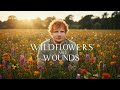 Ed Sheeran Wildflowers And Wounds LoveAfterBrokenness Ed Sheeran Wildflowers And Wounds LoveAfterBrokenness