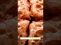 هكذا تشفى العظام بعد كسر كامل #viral #اكسبلور #trending #viralvideo #funny #explore