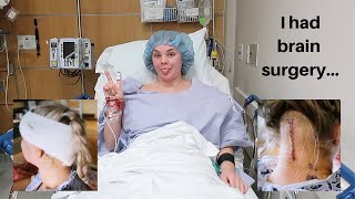 I had brain surgery | chiari malformation decompression
