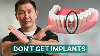 Don't Get Dental Implants Until You Watch THIS! What Dentists Don't Tell You