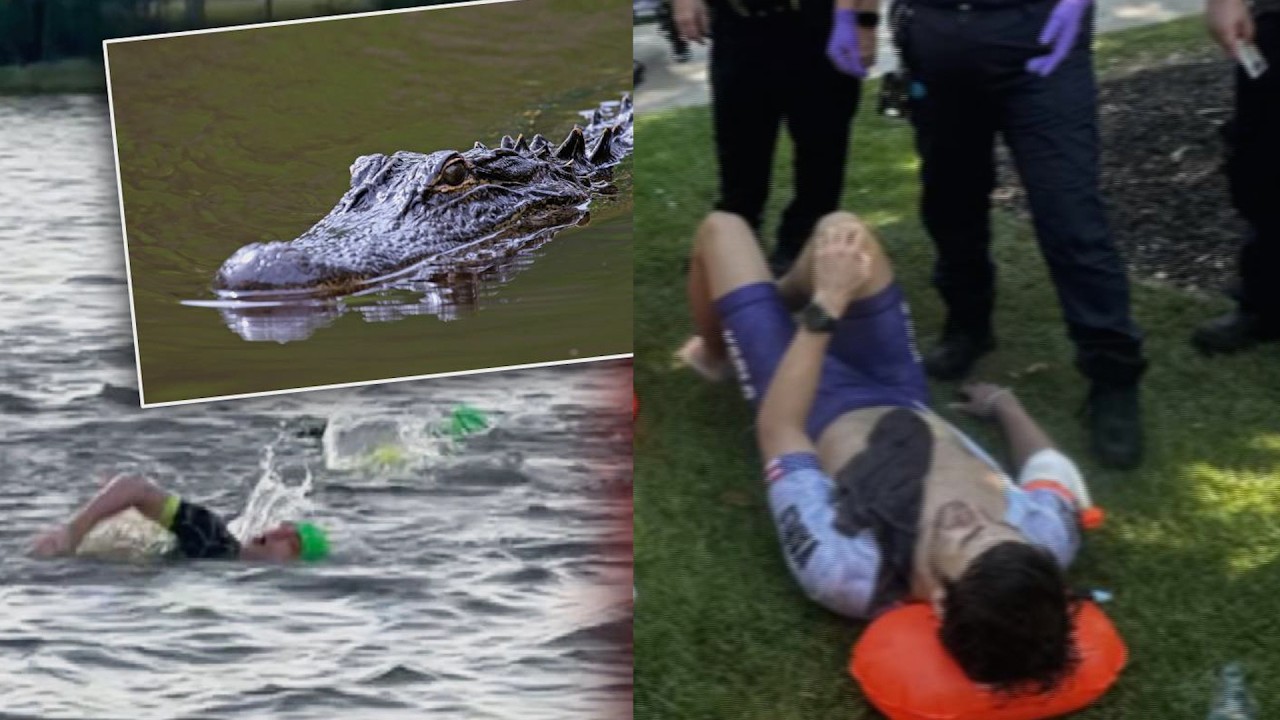 Swimmer Survives Gator Attack By 'Aiming For The Eye'