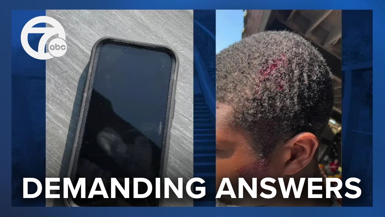 Man says Cedar Point won't provide reports after getting hurt by flying phone