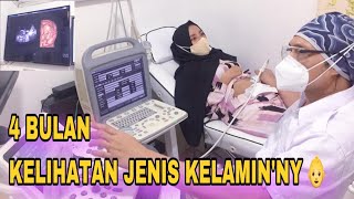 USG 4D JANIN 16 MINGGU KEHAMILAN || TERLIHAT JELAS JENIS KELAMIN BAYI