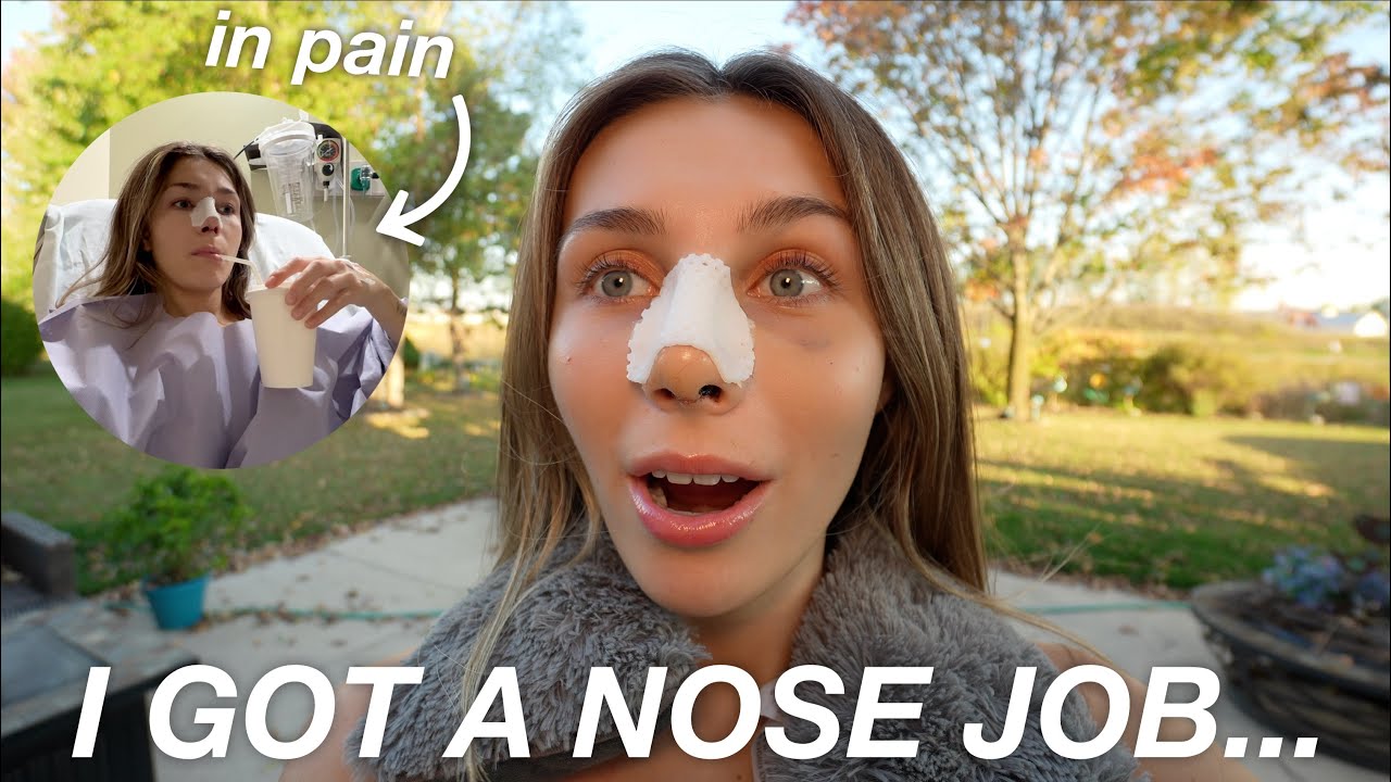 Я сделала ринопластику и записала весь процесс в видеоблог... (обновления до, после и восстановле...