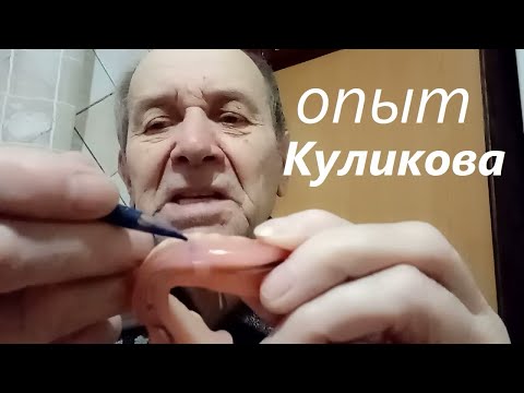 Натирает и давит съемный зубной протез, боль, как помочь? Опыт Куликова.