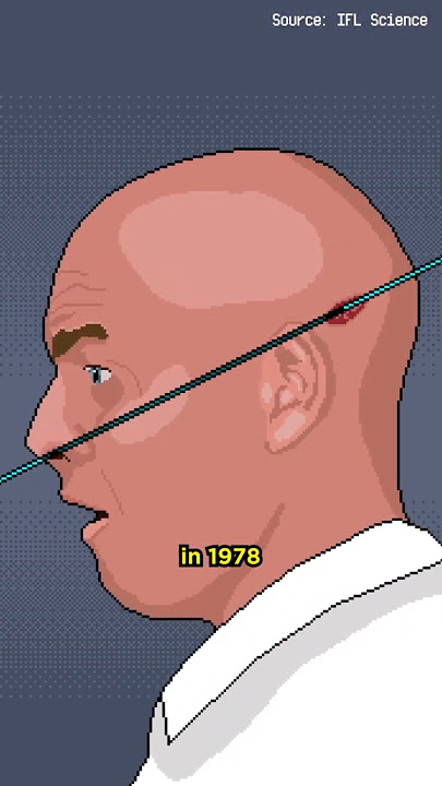 Man Sticks Head in Particle Accelerator 😨