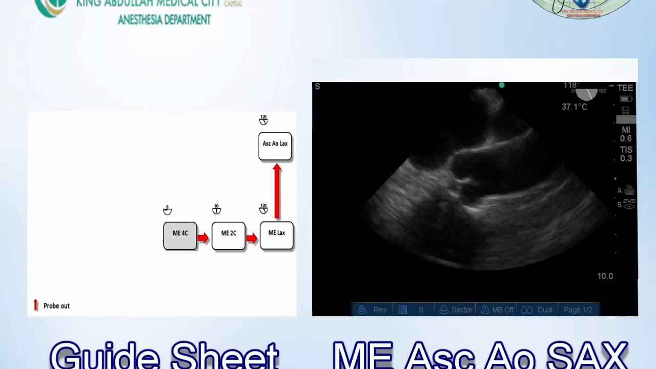 088 Guide Sheet For Basic TEE Examination KAMC YouTube 088-guide-sheet-for-basic-tee-examination-kamc-youtube