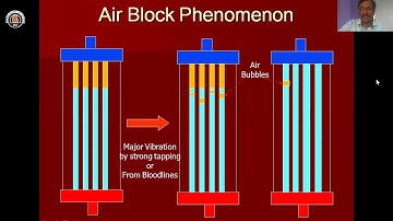 How to avoid Clot in Hemodialyzer| Mumbai Kidney Foundation | Dr Thaigarajan Thandavan