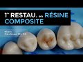 102 - Restauration occlusale en résine composite sur une prémolaire mandibulaire