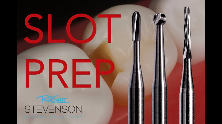 Class II - The Slot Preparation #20 DO Acadental |...