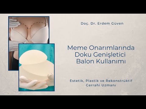 Meme Onarımlarında Doku Genişletici Balon Kullanımı | Meme Onarımı | Doç. Dr. Erdem Güven