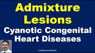 Admixture Lesions