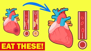 5 Best Foods To Clean & Prevent Clogged Arteries - Clinically Proven
