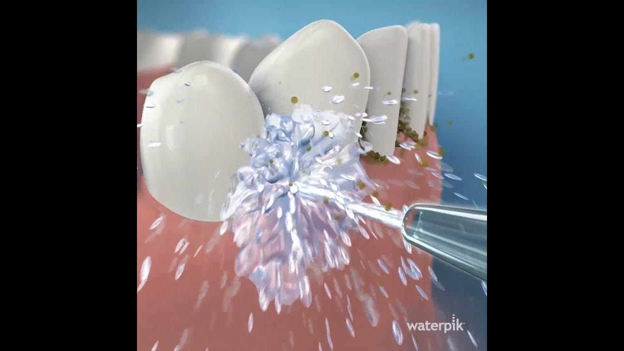 JetFloss Pro Review Is This Water Flosser Worth It? YouTube