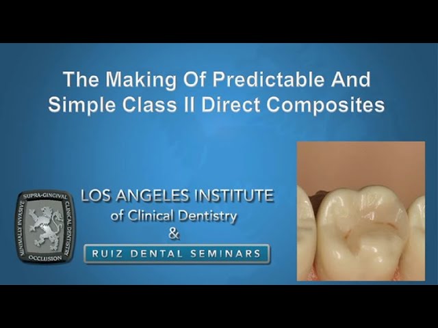 The Making Of Predictable And Simple Class II Direct Composites