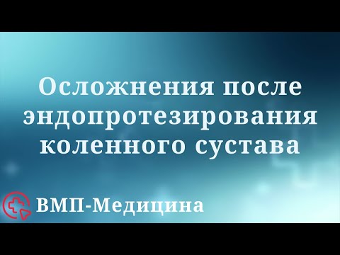 Осложнения после эндопротезирования коленного сустава | ВМП-Медицина