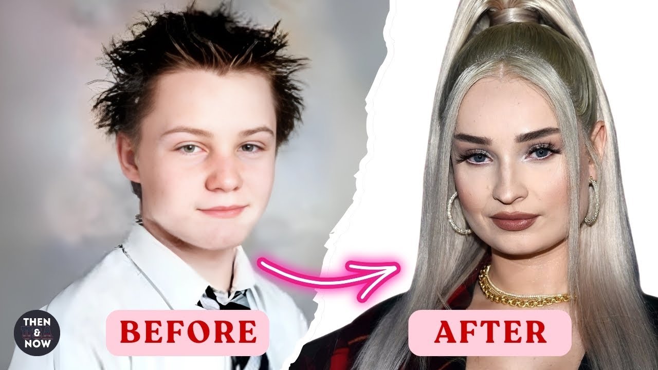 Unbelievable!! 12 Transgender Celebrities Before and After | Then and ...