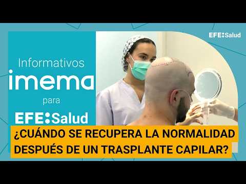 Informativo IMEMA: ¿Cuándo se recupera la rutina después de un trasplante capilar?