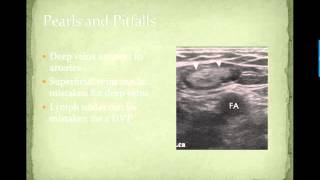 DVT Ultrasound Case Based MS3 Video