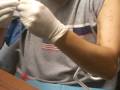 NxStage dialysis treatment: Placing arterial needle