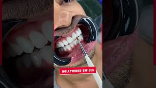 Hollywood Smile Dental Clinic Turkey