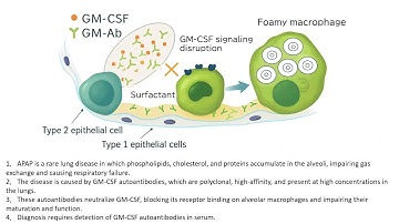 Rapid Serological Detection of Anti-GM-CSF Auto-Abs in Autoimmune Pulmonary Alveolar Proteinosis