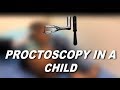 Video Proctoscopy In A Child For Polyp Prolapse Constipation Video Proctoscopy In A Child For Polyp Prolapse Constipation