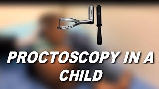 Video proctoscopy in a child for Polyp Prolapse & Constipation.