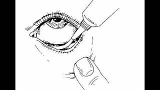 Adult Glue your eyelids together