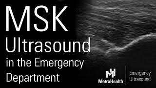 MSK Ultrasound screenshot 2