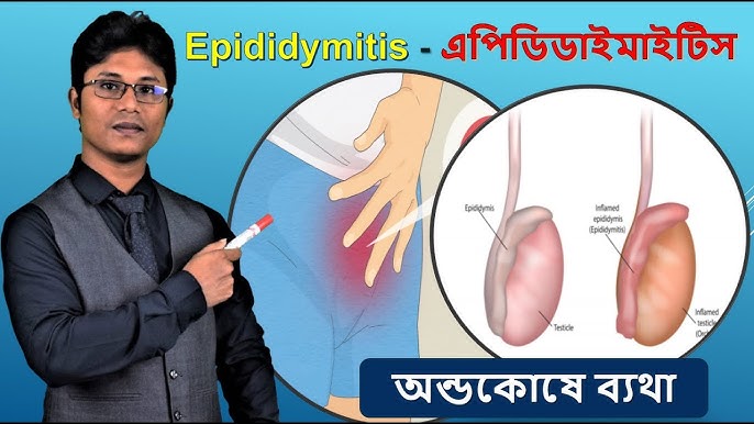 Kompyuteringiz uchun erotik tasvirlar toplami Yapon ayollar yubka fotoforumi