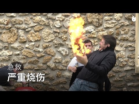 急救：严重烧伤 | 学习急救